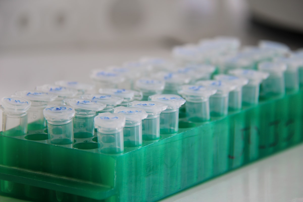 A rack of labelled clear specimen tubes in a laboratory